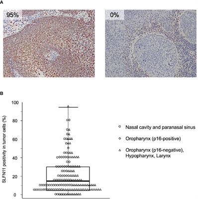 Schlafen family member 11 indicates favorable prognosis of patients with head and neck cancer following platinum-based chemoradiotherapy